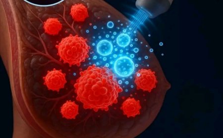 JUST IN: Scientist developed a non-surgical method using ultrasound-triggered microbubbles to destroy breast cancer  cell.