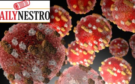 MEASLES CASES AND OUTBREAK IN THE USA