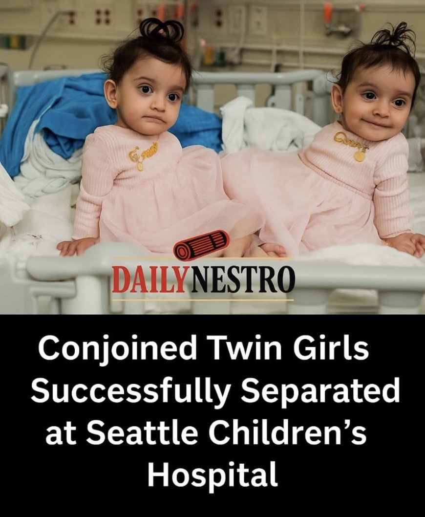 Conjoined Twin Girls Thrive After Successful Separation Surgery in Seattle