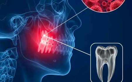 FACT YOU DIDN'T KNOW ABOUT WISDOM TEETH !!