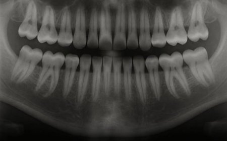 Breakthrough Discovery: New Japanese Drug Allows Humans to Regrow Lost Teeth