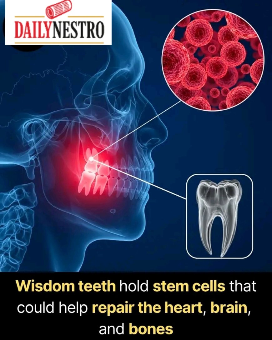 FACT YOU DIDN'T KNOW ABOUT WISDOM TEETH !!
