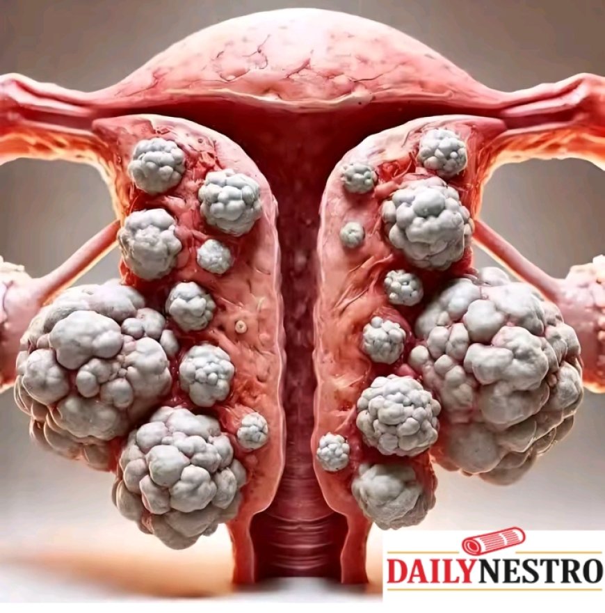 Fibroid Awareness: What Every Woman in the U.S. Needs to Know About Her Reproductive Health